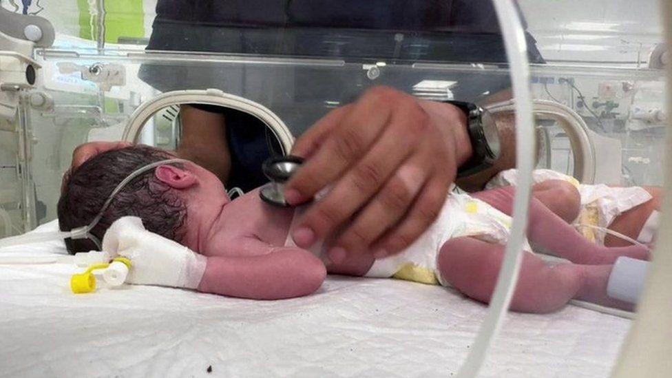 La bebé es atendida por un trabajador médico en una incubadora.