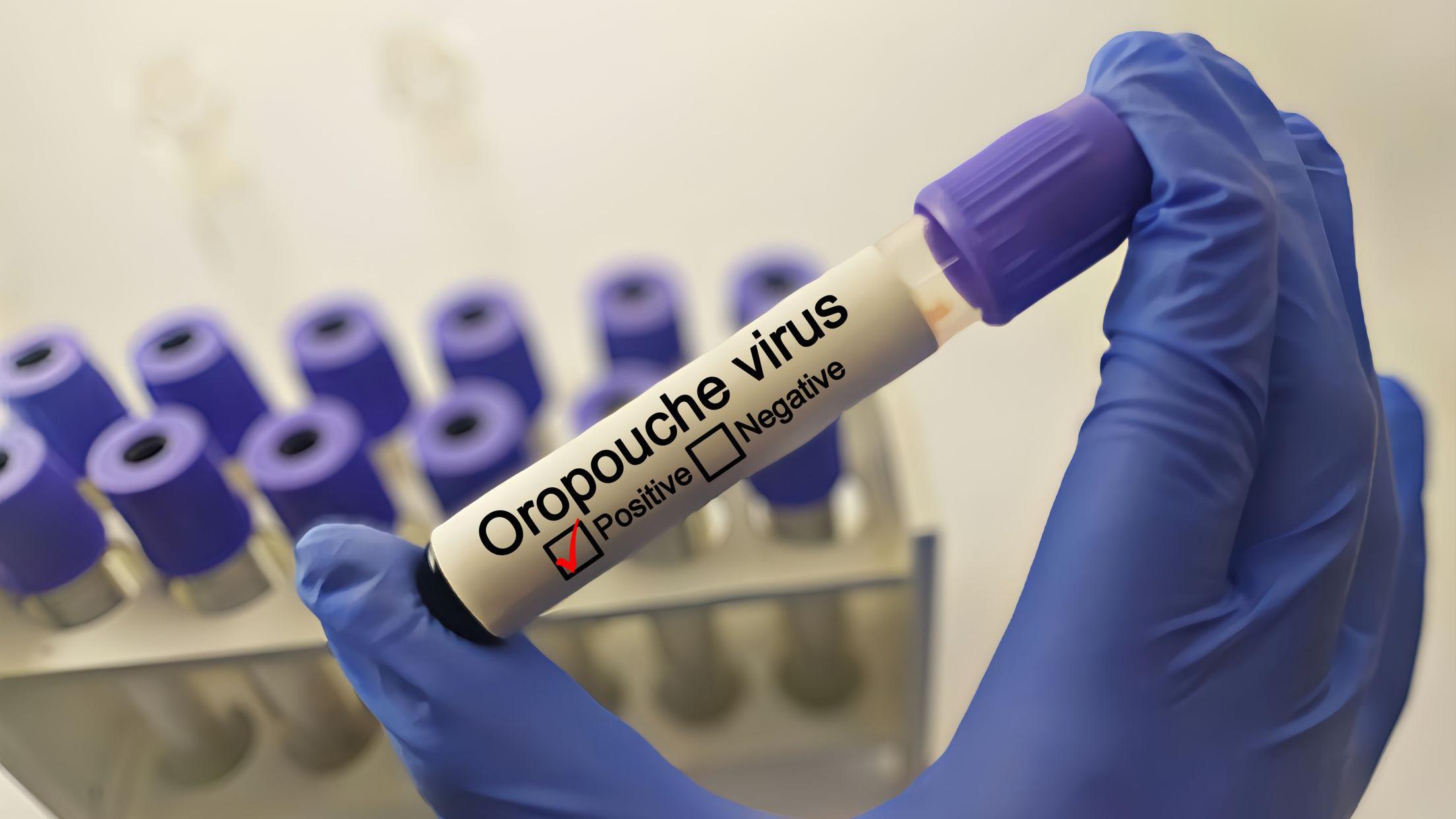 Laboratorio de pruebas del virus Oropouche