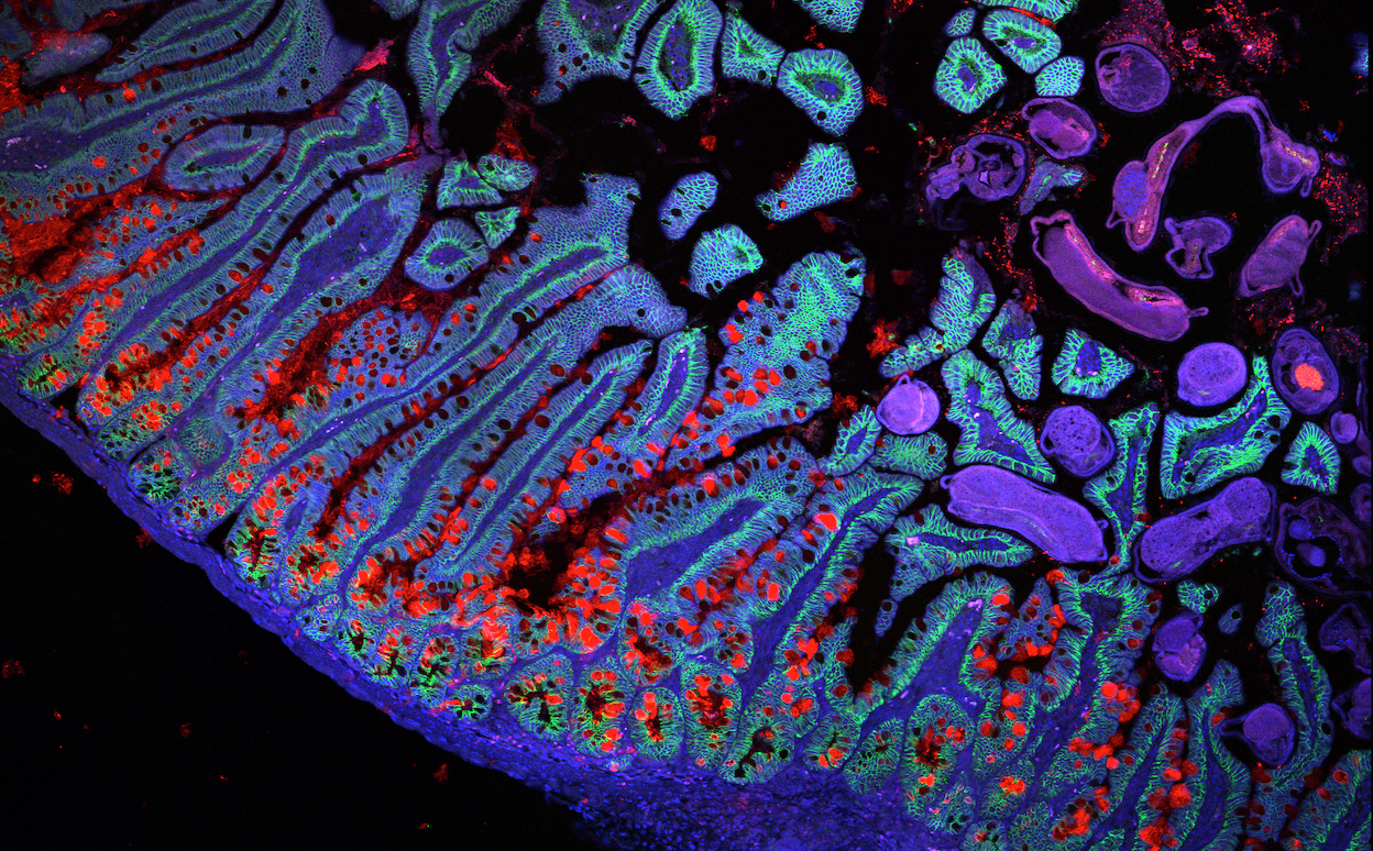 Imagen que muestra cuántos genes se activan para desarrollar el intestino delgado.